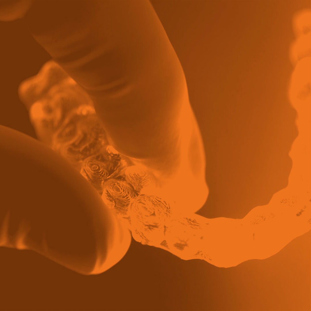 orange-scale image of hands holding a tooth aligner